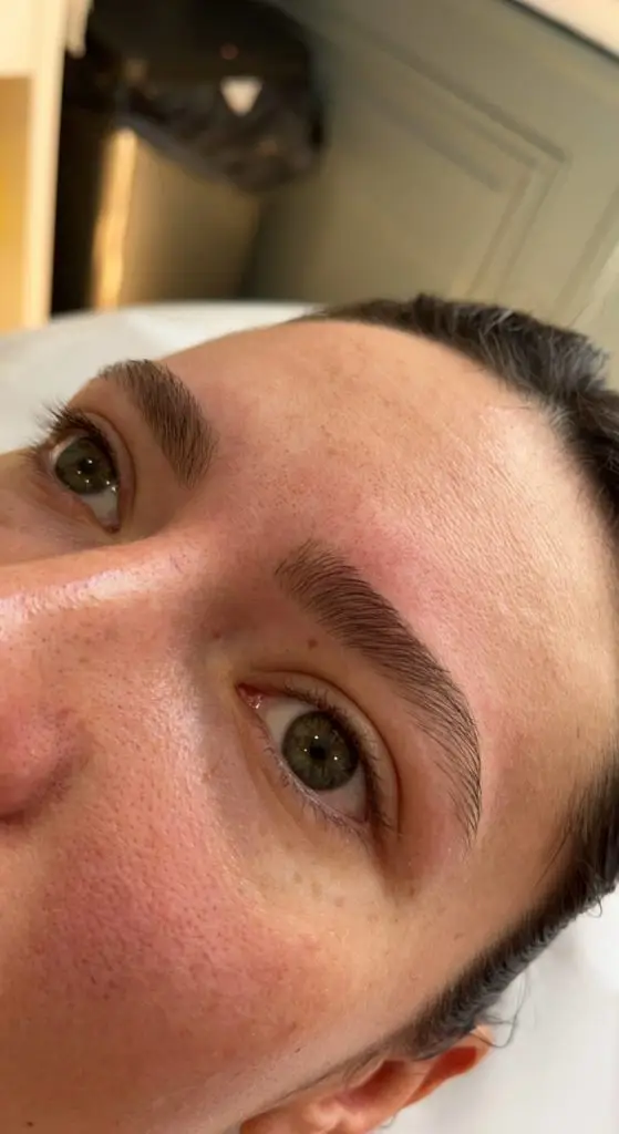 Restructuration des sourcils